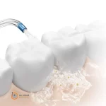 واتر جت شیائومی Xiaomi Water Flosser 2 مدل MEO705 - تصویر 7